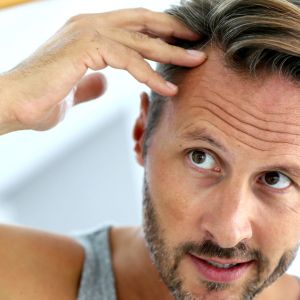 روشهای انجام کاشت موی طبیعی