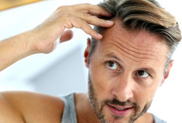 روشهای انجام کاشت موی طبیعی